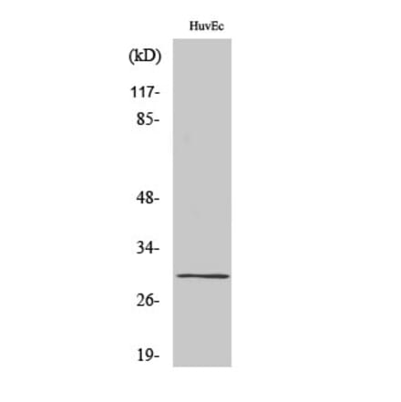 Western blot - CD70 Polyclonal Antibody from Signalway Antibody (40704) - Antibodies.com