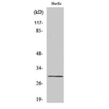 Western blot - CD70 Polyclonal Antibody from Signalway Antibody (40704) - Antibodies.com