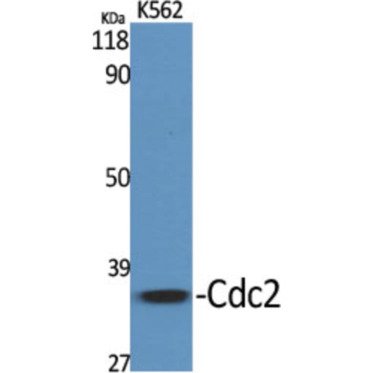 Western blot - Cdc2 Polyclonal Antibody from Signalway Antibody (40710) - Antibodies.com