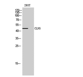 Western blot - CLN5 Polyclonal Antibody from Signalway Antibody (40760) - Antibodies.com