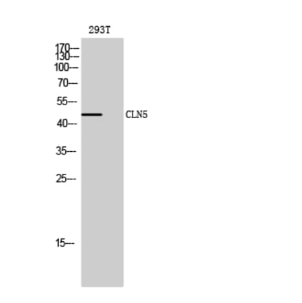 Western blot - CLN5 Polyclonal Antibody from Signalway Antibody (40760) - Antibodies.com