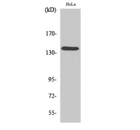 Western blot - DDX8 Polyclonal Antibody from Signalway Antibody (40838) - Antibodies.com