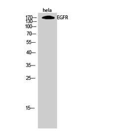 Western blot - EGFR Polyclonal Antibody from Signalway Antibody (40869) - Antibodies.com