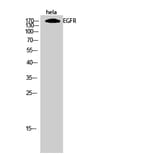 Western blot - EGFR Polyclonal Antibody from Signalway Antibody (40869) - Antibodies.com
