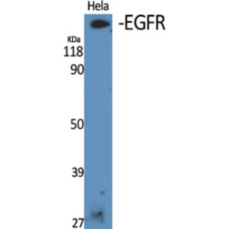 Western blot - EGFR Polyclonal Antibody from Signalway Antibody (40869) - Antibodies.com