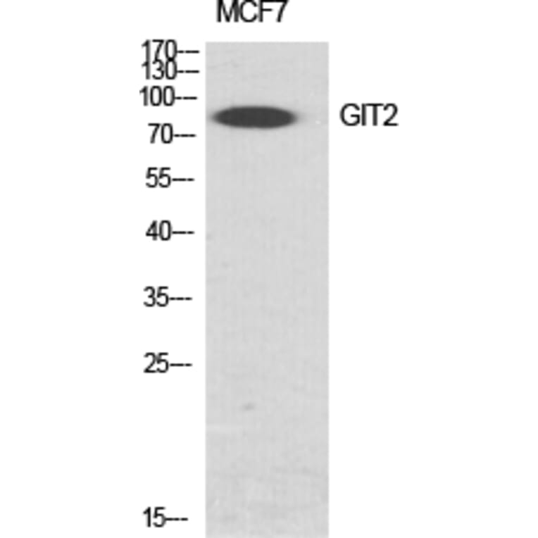 Western blot - GIT2 Polyclonal Antibody from Signalway Antibody (40963) - Antibodies.com