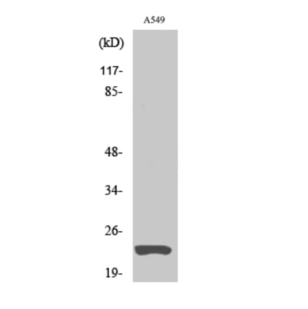 Western blot - MAD2 Polyclonal Antibody from Signalway Antibody (41117) - Antibodies.com