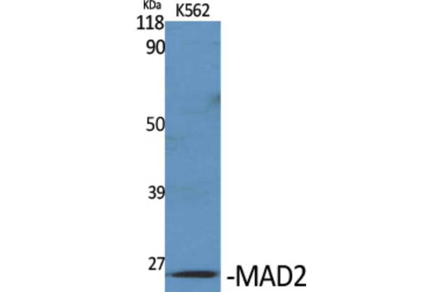 Western blot - MAD2 Polyclonal Antibody from Signalway Antibody (41117) - Antibodies.com