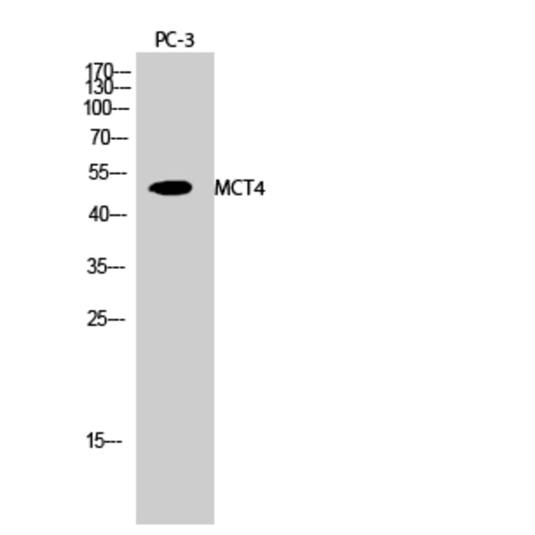 Western blot - MCT4 Polyclonal Antibody from Signalway Antibody (41126) - Antibodies.com