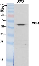 Western Blot analysis of lovo cells using MCT4 Polyclonal Antibody
