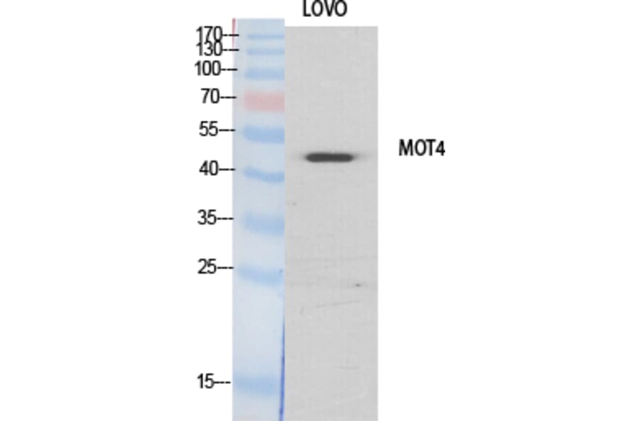 Western blot - MCT4 Polyclonal Antibody from Signalway Antibody (41126) - Antibodies.com