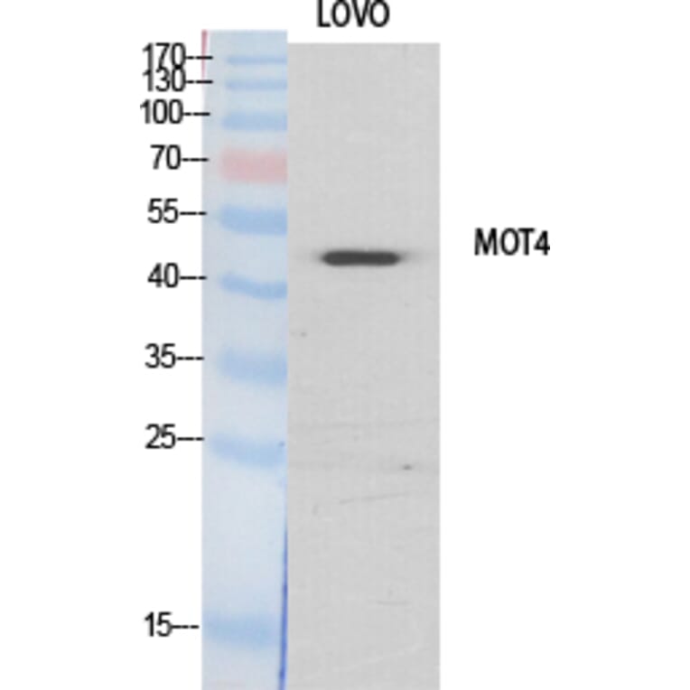 Western blot - MCT4 Polyclonal Antibody from Signalway Antibody (41126) - Antibodies.com