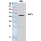 Western blot - MCT4 Polyclonal Antibody from Signalway Antibody (41126) - Antibodies.com