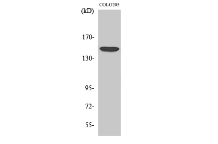 Western blot - MRP7 Polyclonal Antibody from Signalway Antibody (41167) - Antibodies.com