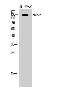 Western Blot analysis of SH-SY5Y cells using NOS2 Polyclonal Antibody