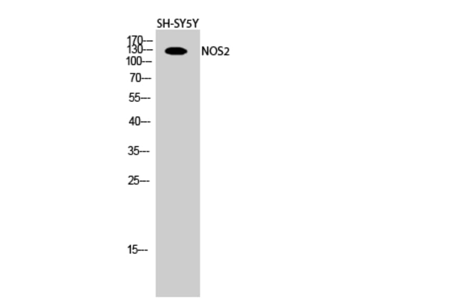 Western blot - NOS2 Polyclonal Antibody from Signalway Antibody (41249) - Antibodies.com