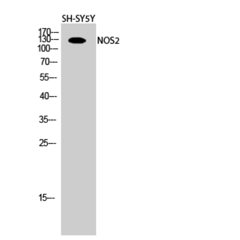 Western blot - NOS2 Polyclonal Antibody from Signalway Antibody (41249) - Antibodies.com