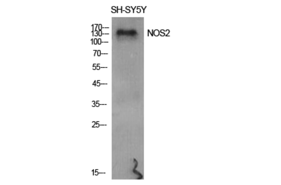 Western blot - NOS2 Polyclonal Antibody from Signalway Antibody (41249) - Antibodies.com