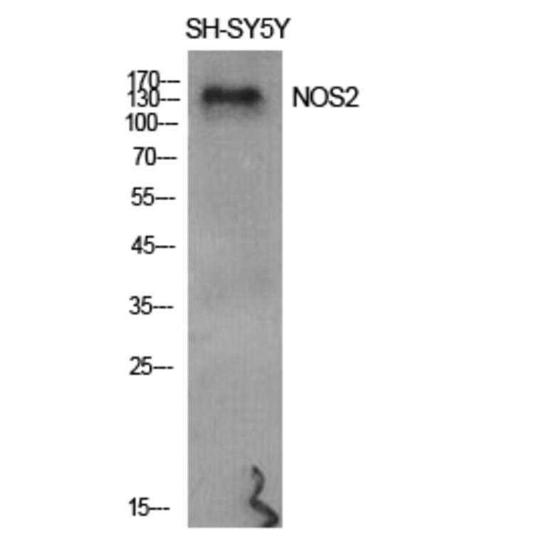 Western blot - NOS2 Polyclonal Antibody from Signalway Antibody (41249) - Antibodies.com
