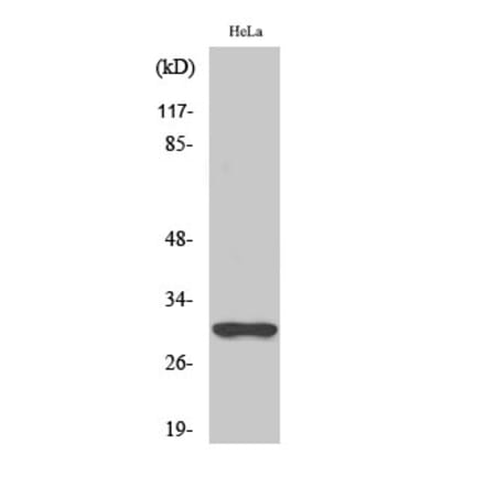 Western blot - NQO1 Polyclonal Antibody from Signalway Antibody (41254) - Antibodies.com