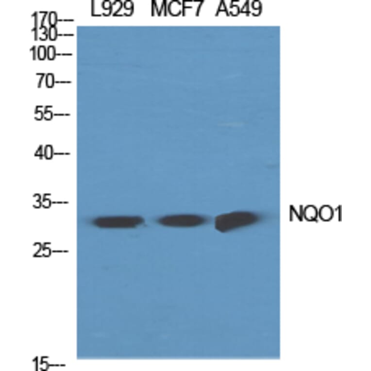 Western blot - NQO1 Polyclonal Antibody from Signalway Antibody (41254) - Antibodies.com