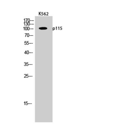 Western blot - p115 Polyclonal Antibody from Signalway Antibody (41294) - Antibodies.com