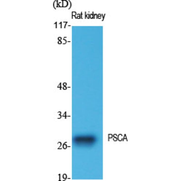 Western blot - PSCA Polyclonal Antibody from Signalway Antibody (41364) - Antibodies.com