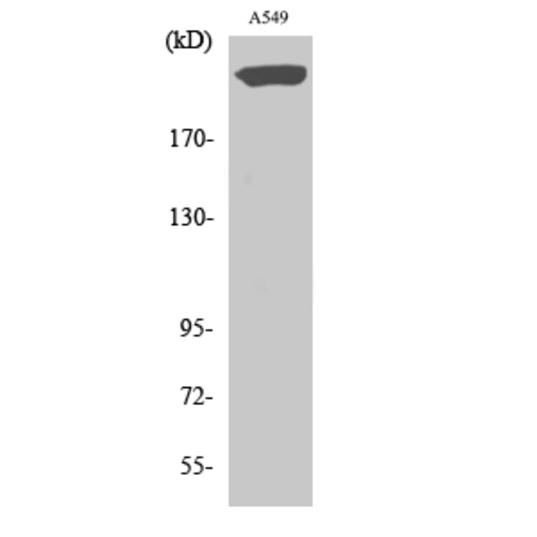 Western blot - PTPζ Polyclonal Antibody from Signalway Antibody (41370) - Antibodies.com