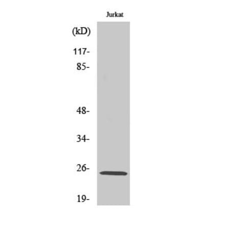 Western blot - Rit1 Polyclonal Antibody from Signalway Antibody (41413) - Antibodies.com