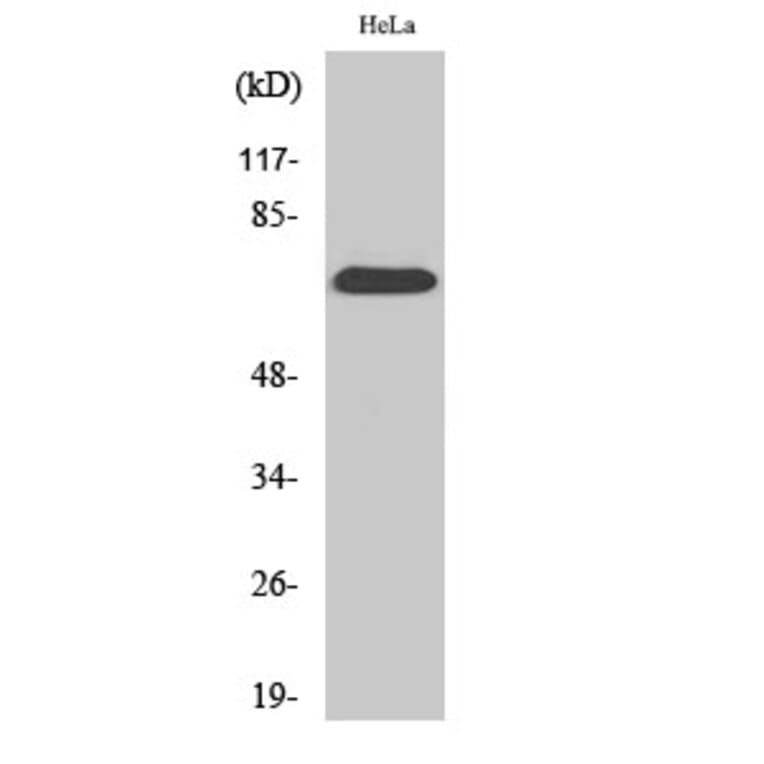 Western blot - SDHA Polyclonal Antibody from Signalway Antibody (41423) - Antibodies.com