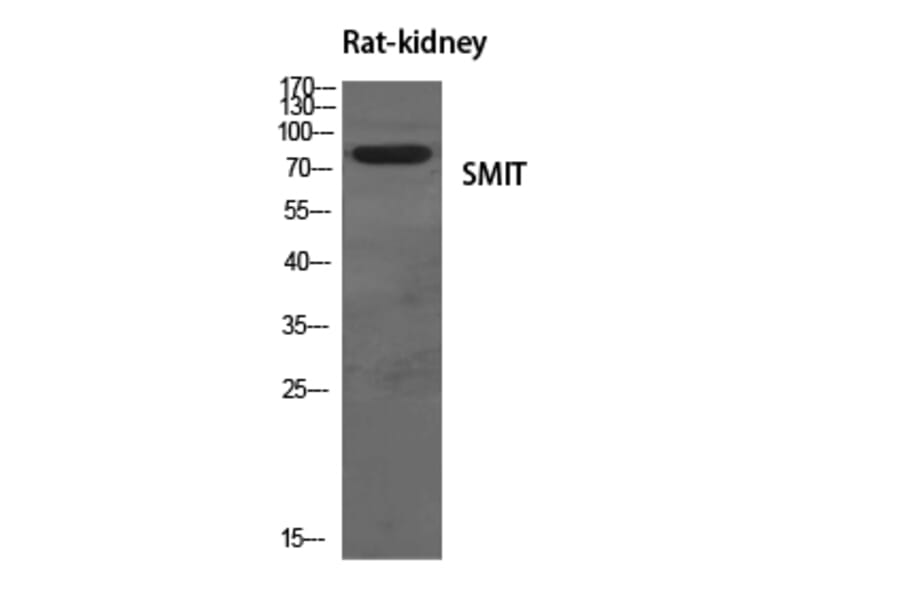 Western blot - SMIT Polyclonal Antibody from Signalway Antibody (41447) - Antibodies.com