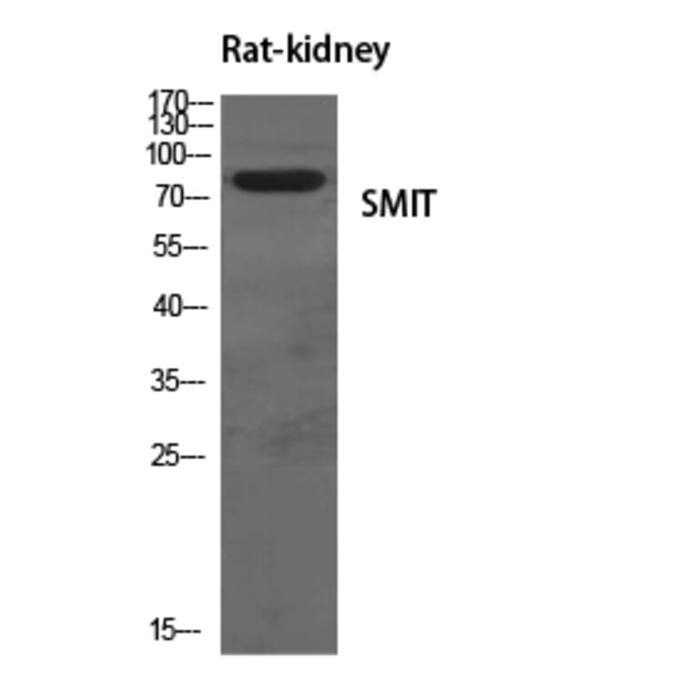 Western blot - SMIT Polyclonal Antibody from Signalway Antibody (41447) - Antibodies.com
