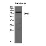 Western blot - SMIT Polyclonal Antibody from Signalway Antibody (41447) - Antibodies.com