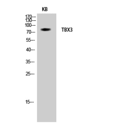 Western blot - TBX3 Polyclonal Antibody from Signalway Antibody (41482) - Antibodies.com