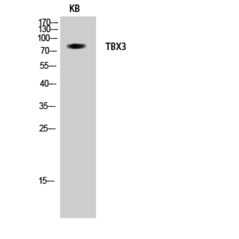 Western blot - TBX3 Polyclonal Antibody from Signalway Antibody (41482) - Antibodies.com