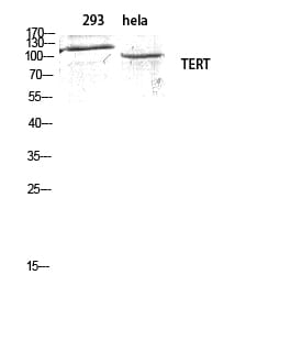 Western Blot analysis of 293 hela cells using TERT Polyclonal Antibody