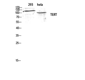 Western blot - TERT Polyclonal Antibody from Signalway Antibody (41485) - Antibodies.com