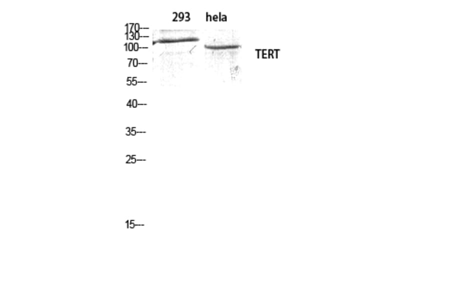 Western blot - TERT Polyclonal Antibody from Signalway Antibody (41485) - Antibodies.com