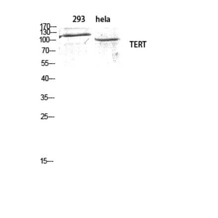 Western blot - TERT Polyclonal Antibody from Signalway Antibody (41485) - Antibodies.com