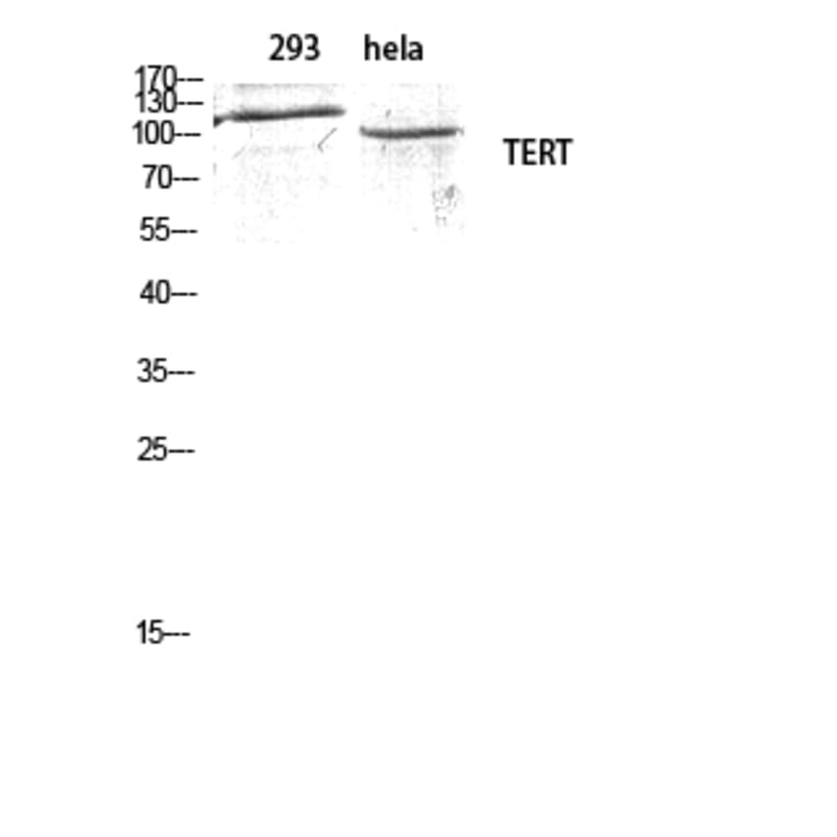 Western blot - TERT Polyclonal Antibody from Signalway Antibody (41485) - Antibodies.com