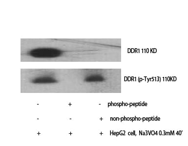 Western Blot analysis of HepG2+NA3VO4 cells using DDR1 Polyclonal Antibody