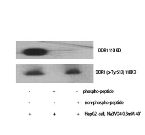 Western blot - DDR1 Polyclonal Antibody from Signalway Antibody (41546) - Antibodies.com