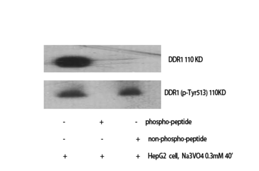 Western blot - DDR1 Polyclonal Antibody from Signalway Antibody (41546) - Antibodies.com