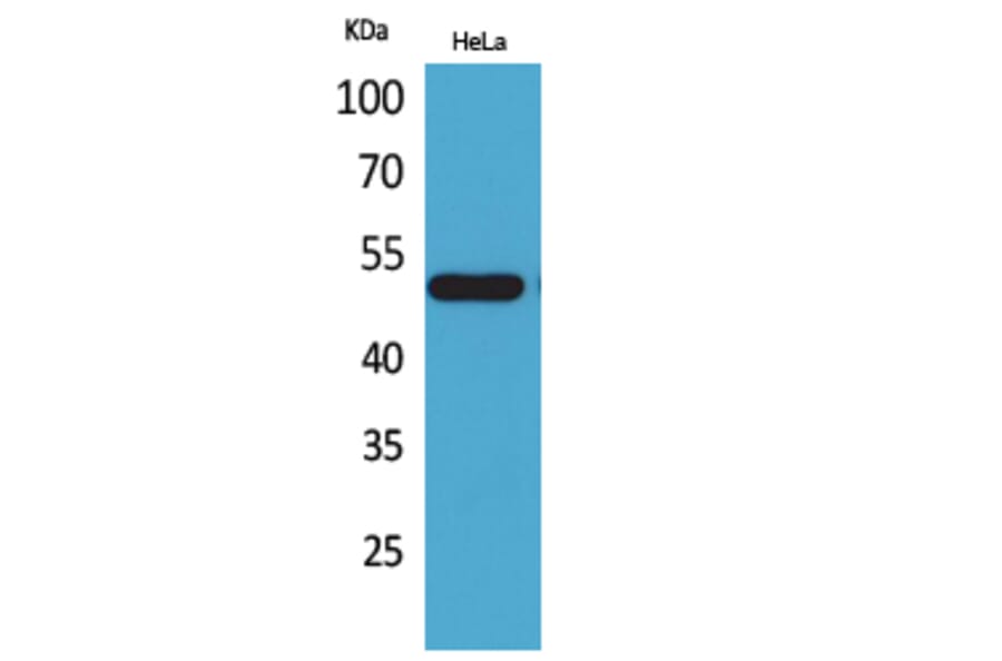 Western blot - LXRα Polyclonal Antibody from Signalway Antibody (41558) - Antibodies.com