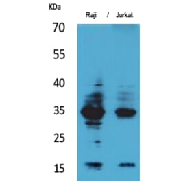 Western blot - IL-4 Polyclonal Antibody from Signalway Antibody (41560) - Antibodies.com