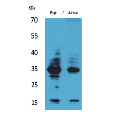 Western blot - IL-4 Polyclonal Antibody from Signalway Antibody (41560) - Antibodies.com
