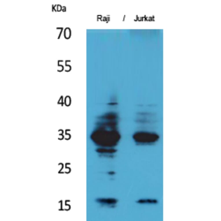 Western blot - IL-4 Polyclonal Antibody from Signalway Antibody (41560) - Antibodies.com
