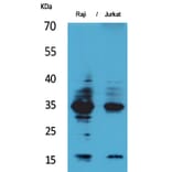Western blot - IL-4 Polyclonal Antibody from Signalway Antibody (41560) - Antibodies.com