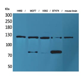 Western blot - CD56 Polyclonal Antibody from Signalway Antibody (41561) - Antibodies.com
