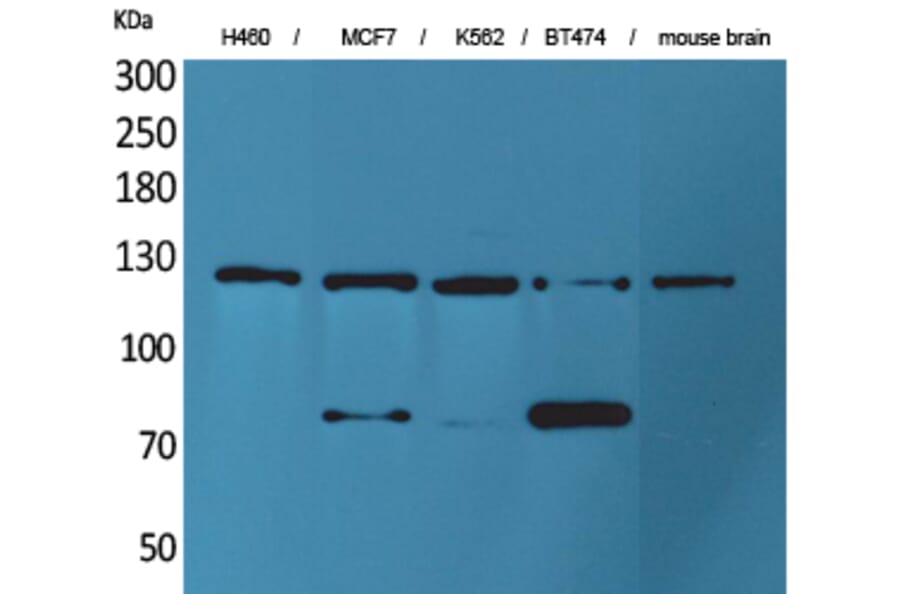 Western blot - CD56 Polyclonal Antibody from Signalway Antibody (41561) - Antibodies.com